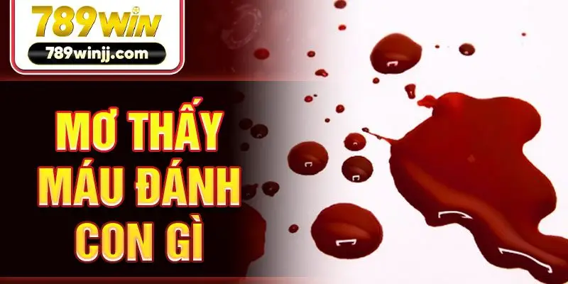 mo-thay-mau-danh-con-gi